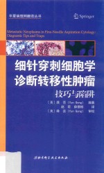 细针穿刺细胞学诊断转移性肿瘤  技巧与陷阱