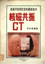 核磁共振CT