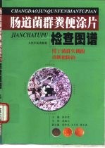 肠道菌群粪便涂片检查图谱  用于菌群失调的诊断和防治