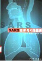 SARS临床及X线图析