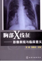 胸部X线征  影像表现与临床意义