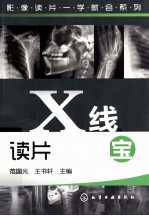 X线读片掌中宝