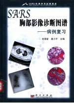 SARS胸部影像诊断图谱 病例复习