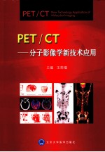 PET/CT  分子影像新技术应用