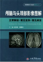 颅脑与头颈部影像图解  正常解剖-常见变异-常见病变