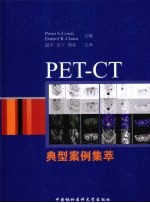 PET-CT典型案例集萃