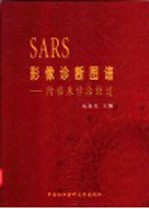 SARS影像诊断图谱-附临床诊治经过