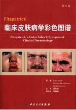 Fitzpatrick临床皮肤病学彩色图谱  第5版