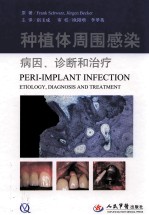 牙种植体周围感染病因、诊断和治疗