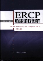 ERCP临床诊疗图解