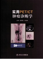 实用PET/CT肿瘤诊断学