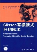 Glisson  蒂横断式肝切除木