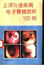 上消化道疾病电子胃镜图析100例