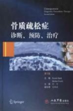 骨质疏松症  诊断、预防、治疗