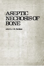 aseptic necrosis of bone