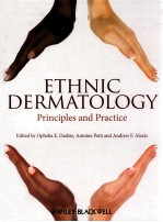 ETHNIC DERMATOLOGY PRINCIPLES AND PRACTICE