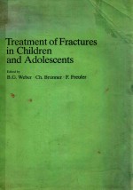 Treatment of fractures in children and adolescents