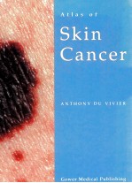 Atlas of Skin Cancer