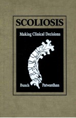 SCOLIOSIS MAKING CLINICAL DECISIONS