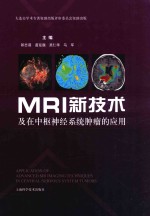 MRI新技术及在中枢神经系统肿瘤的应用