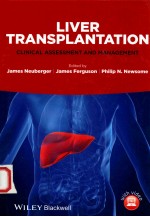 LIVER TRANSPLANTATION CLINICAL ASSESSMENT AND MANAGEMENT