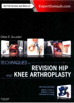 TECHNIQUES IN REVISION HIP AND KNEE ARTHROPLASTY