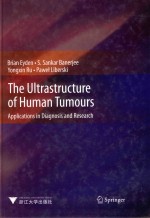 THE ULTRASTRUCTURE OF HUMAN TUMOURS APPLICATIIONS IN DIAGONSIS AND RESEARCH=人体肿瘤超微结构在其诊断及研究中的应用