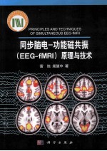 同步脑电  功能磁共振（EEG-fMRI）原理与技术