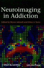 Neuroimaging in Addiction