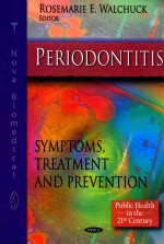 PERIODONTITIS  SYMPTOMS