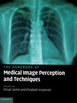 The handbook of medical image perception and techniques