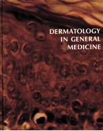 DERMATOLOGY IN GENERAL MEDICINE