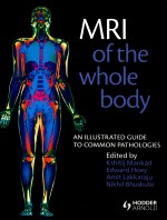 MRI OF THE WHOLE BODY  AN ILLUSTRATED GUIDE TO COMMON PATHOLOGIES