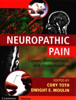 NEUROPATHIC PAIN  CAUSES