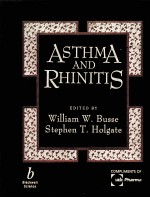 ASTHMA AND RHINITIS