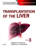 TRANSPLANTATION OF THE LIVER THIRD RDITION