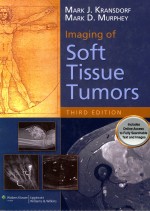 IMAGING OF SOFT TISSUE TUMORS THIRD EDITION