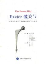 骨水泥全髋关节置换40年的历史与发展  Exeter 髋关节