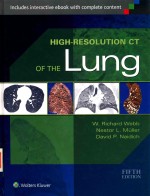 HIGH-RESOLUTION CT OF THE LUNG FIFTH EDITION