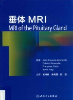 垂体MRI  翻译版