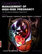 QUEENAN'S MANAGEMENT OF HIGH-RISK PREGNANCY AN EVIDENCE-BASED APPROACH