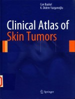 CHINICAL ATLAS OF SKIN TUMORS