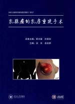 乳腺癌的乳房重建手术