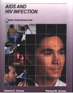 AIDS AND HIV INFECTION