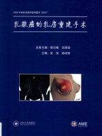 乳腺癌的乳房重建手术