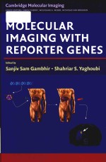 Molecular imaging with reporter genes