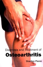 Diagnosis and Treatment of Osteoarthritis