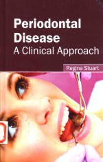 Periodontal Disease A Clinical Approach