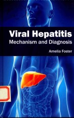 Viral Hepatitis  Mechaniam and Diagnosis