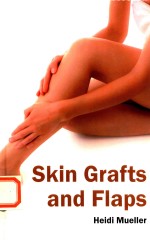 Skin Grafts and Flaps